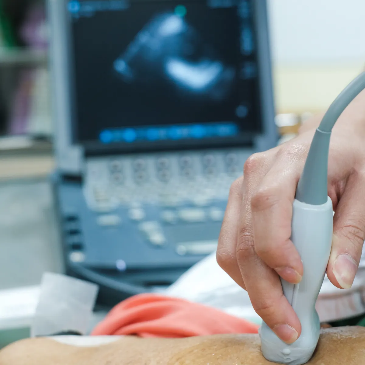 Ecocardiograma de estres con prueba de esfuerzo o farmacológica