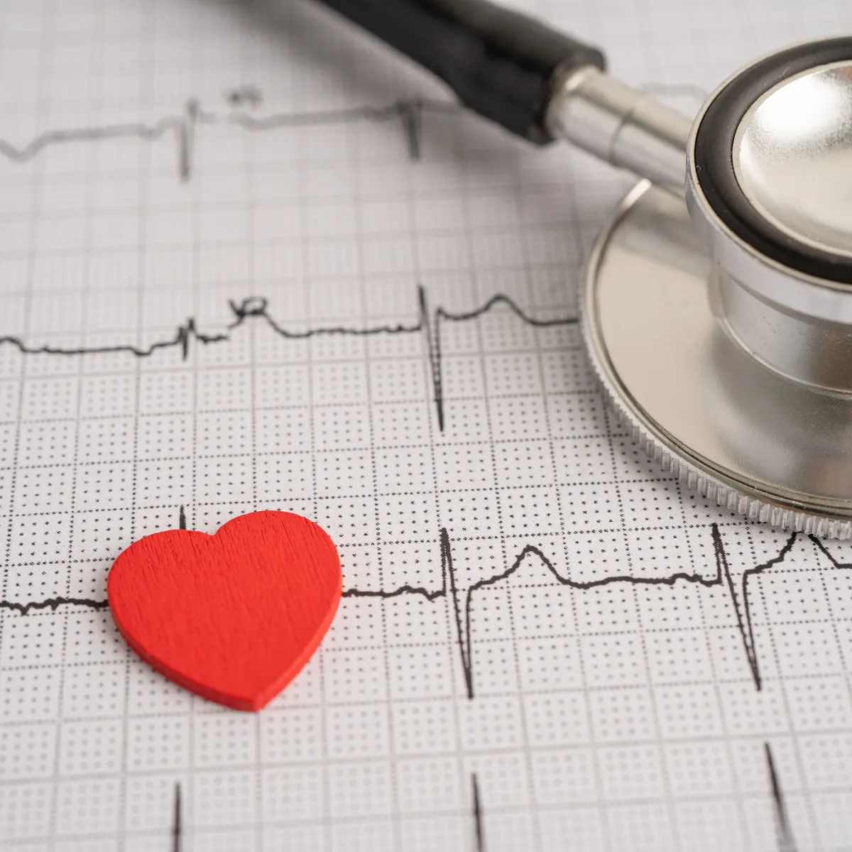 Electrocardiograma de ritmo o de superficie